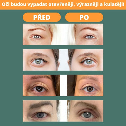 Szemhéj emelő szalagok (400 db)